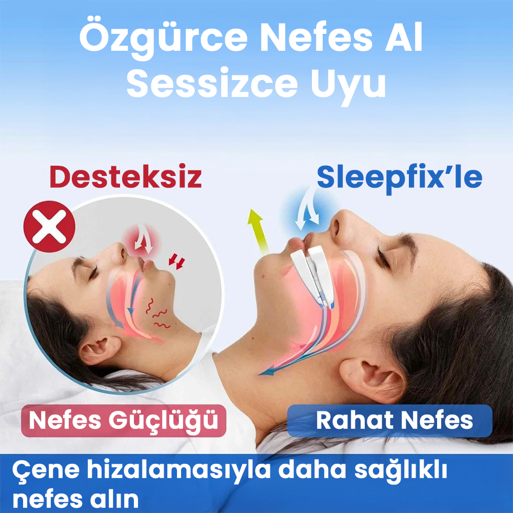 Sleepfix Horlama Karşıtı Ağızlık
