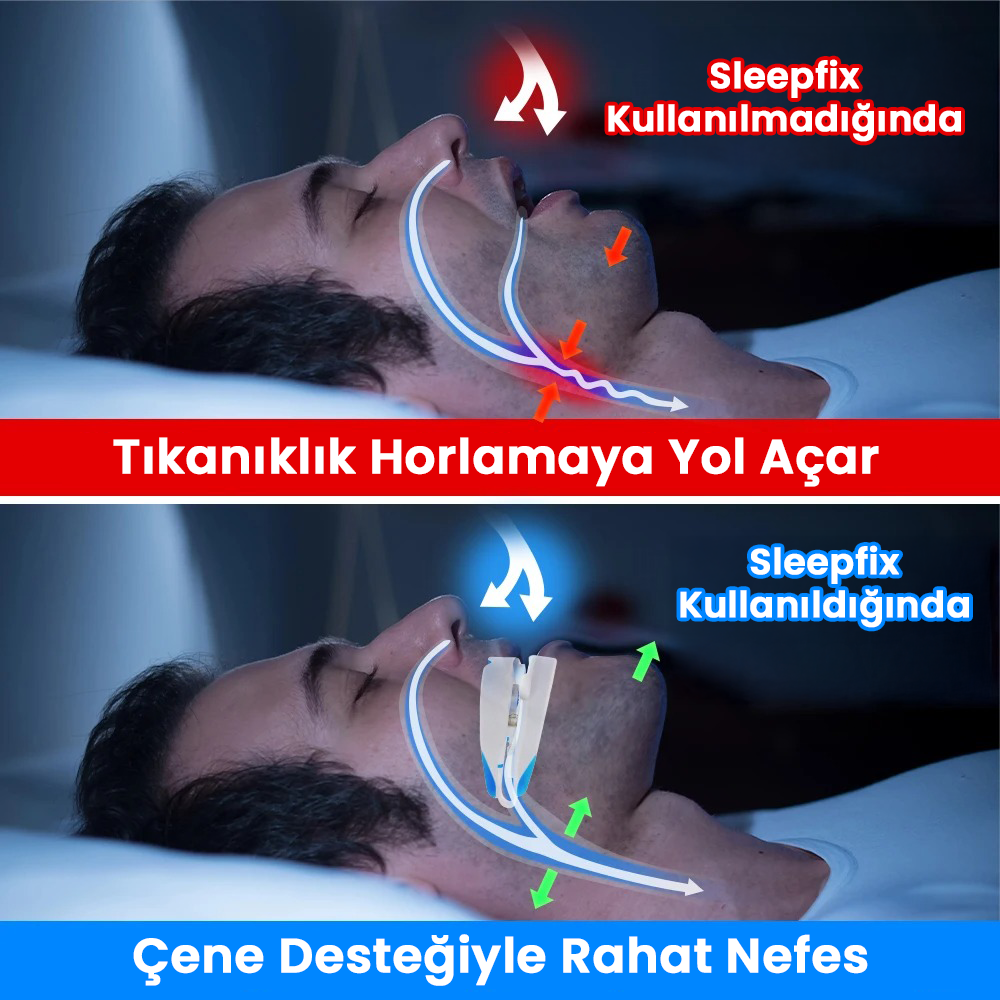 Sleepfix Horlama Karşıtı Ağızlık
