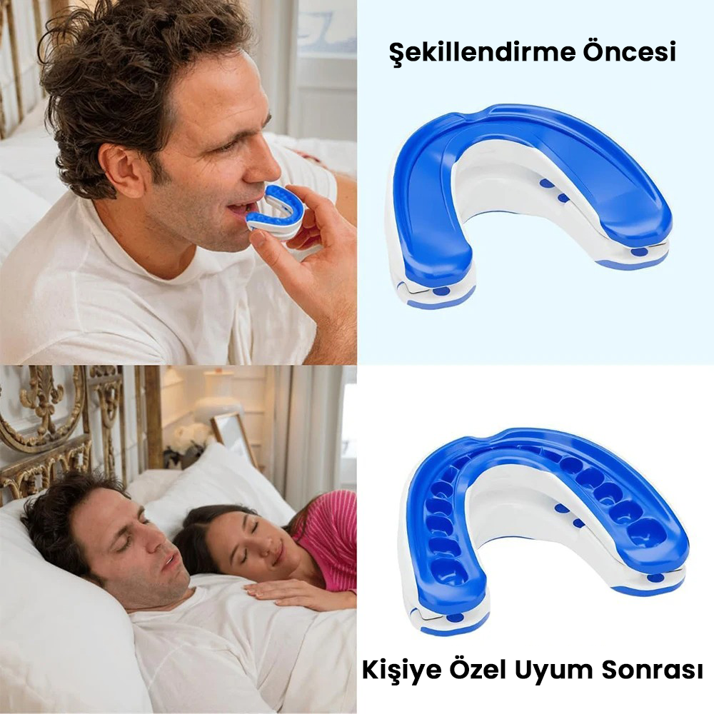 Sleepfix Horlama Karşıtı Ağızlık
