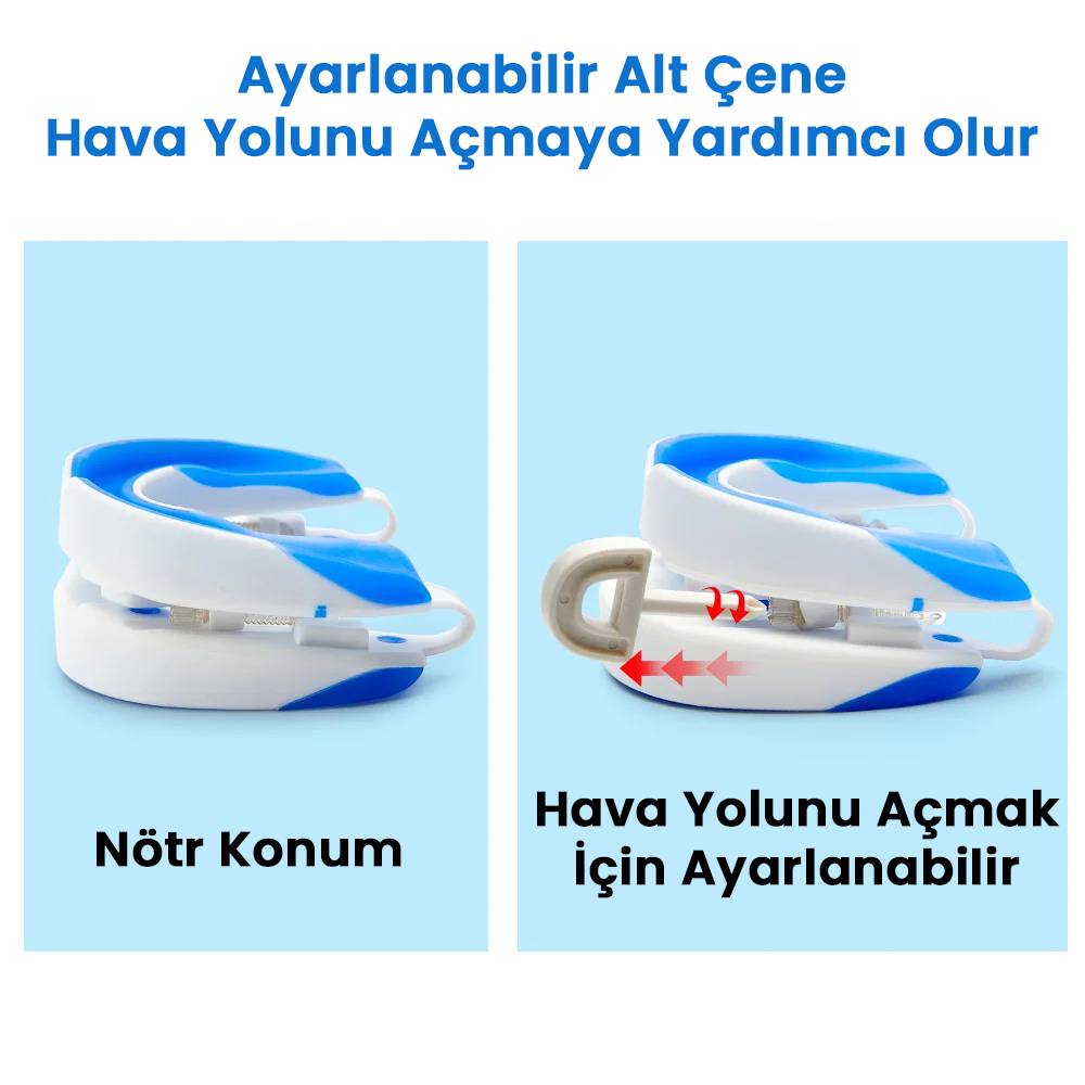 Sleepfix Horlama Karşıtı Ağızlık
