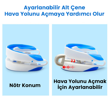 Sleepfix Horlama Karşıtı Ağızlık
