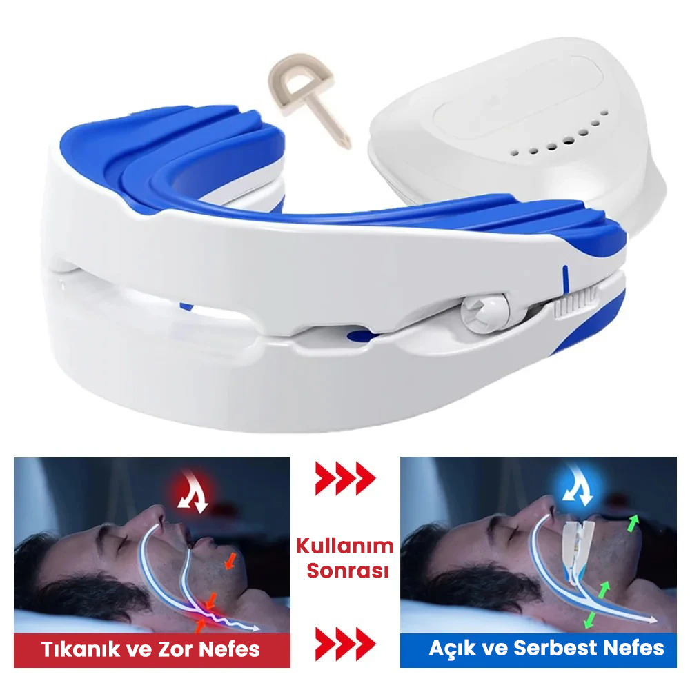 Sleepfix Horlama Karşıtı Ağızlık